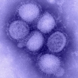 Elektronenmikroskopaufnahme von H1N1